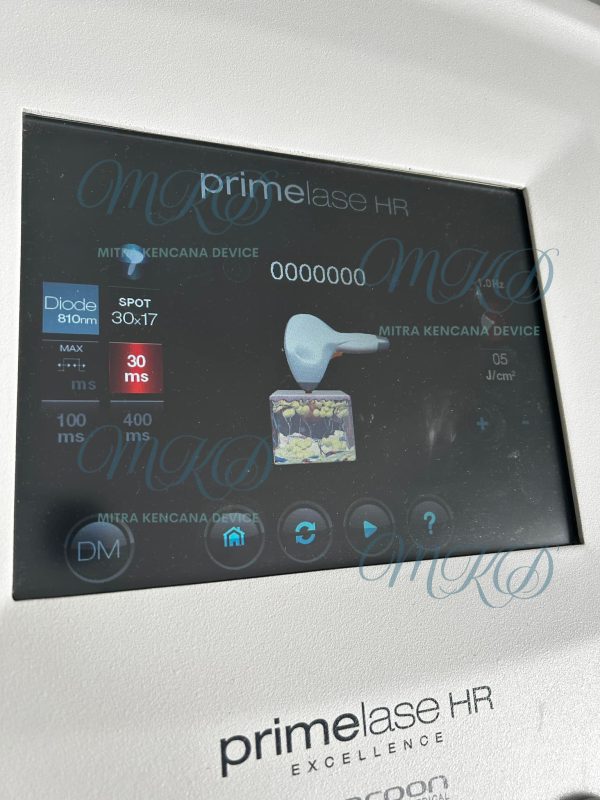 Cocoon Medical Primelase Laser Hair Removal Machines - Image 3