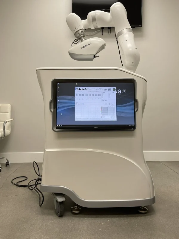 Artas iX Robotic Hair Transplant - Image 5