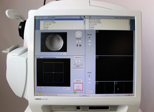 Carl Zeiss Cirrus HD OCT 5000 - Image 4
