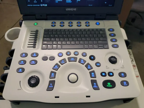 GE Logiq V2 Ultrasound System - Image 3
