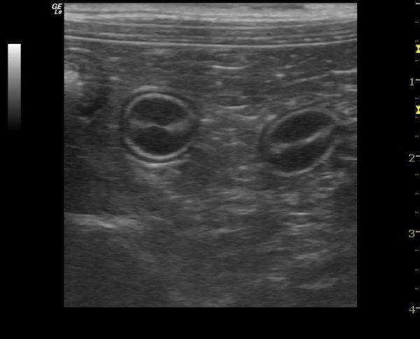 GE Logiq e Vet Ultrasound Device - Image 4