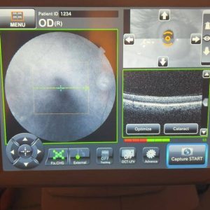 Topcon 3D OCT-1 Maestro 2