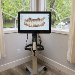iTero Lumina Intraoral Scanner Unit