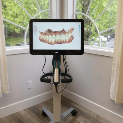 iTero Lumina Intraoral Scanner