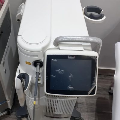FOTONA XP Dynamis Laser